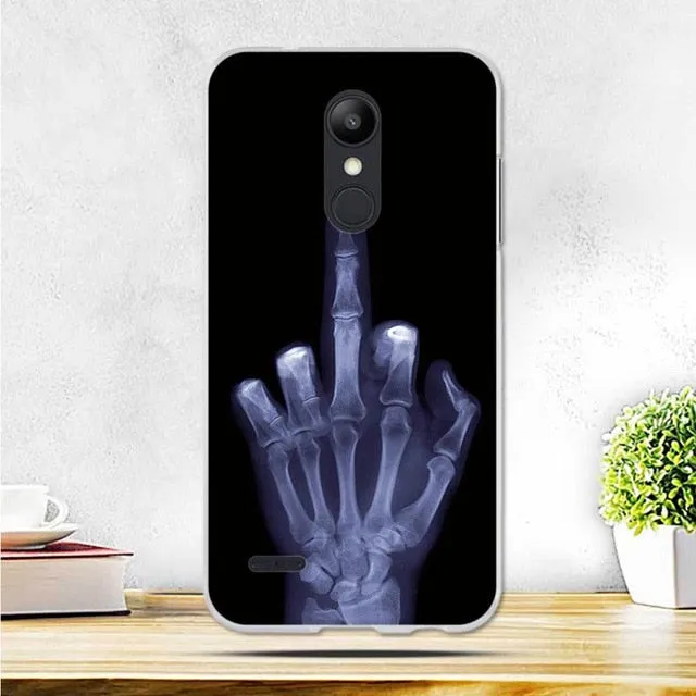 Luxury Back Case for LG K10 2018 Case For LG K11 Cover Soft Thin Silicon TPU Phone Case For LG K10  Plus 2018 Back Shells Bags